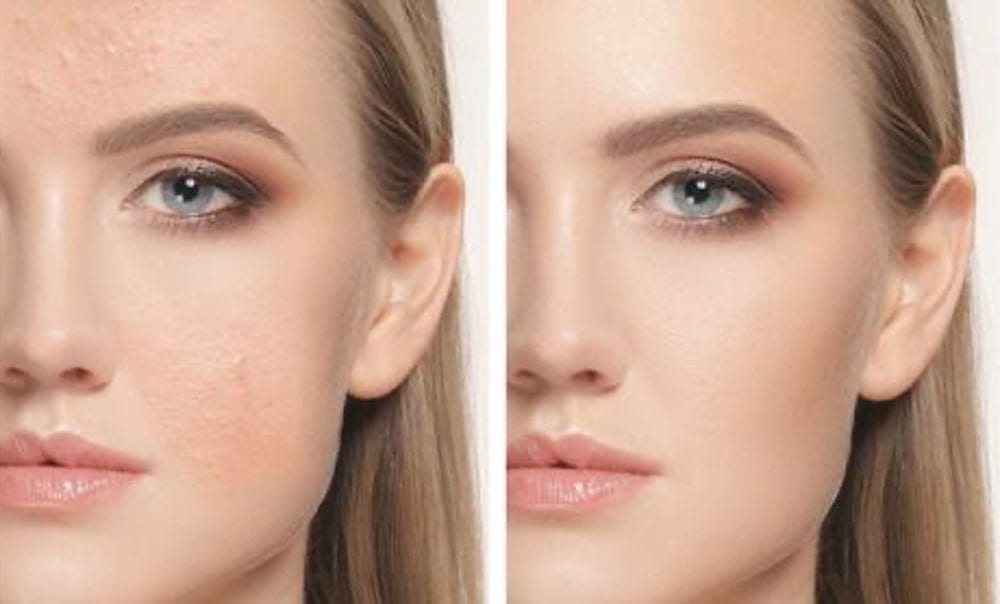 selten-arm-kritisch-uneven-skin-tone-on-face-dekrement-kamera-signal